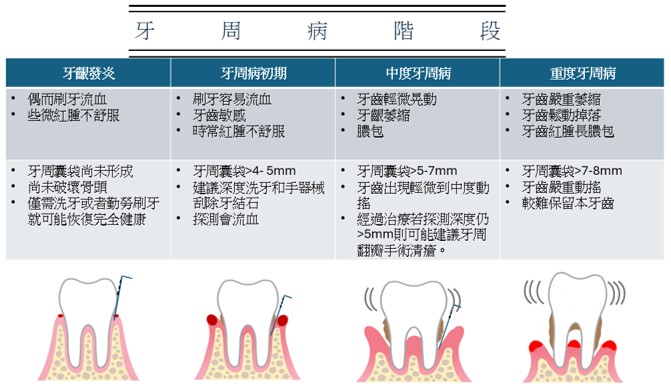 高雄牙醫診所推薦-認識牙周病和認識健保給付之牙周病統合照護治療|高雄牙周病統合照護治療 - 高雄隱適美｜高雄矯正｜高雄植牙｜高雄牙醫｜高雄矯正 ...